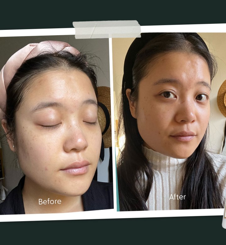 Sunday Riley Good Genes Review: Original before and after photos of Marissa Wu