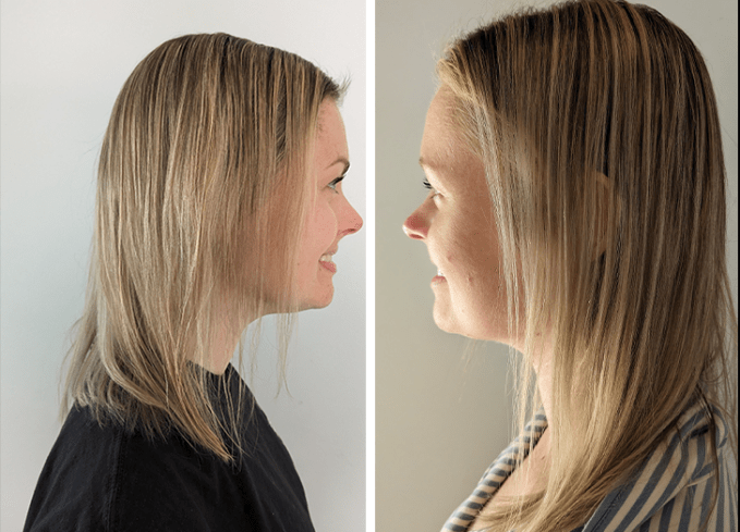 the ordinary hair serum review: before and after for PureWow VP of Editorial Candace Davison